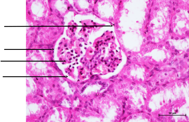 Bronchus